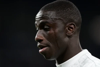 "Real" players undergo surgery
